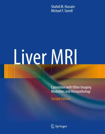 Cover of Liver MRI