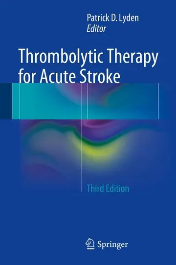 Cover of Thrombolytic Therapy for Acute Stroke