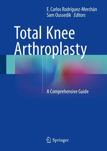 Cover of Total Knee Arthroplasty
