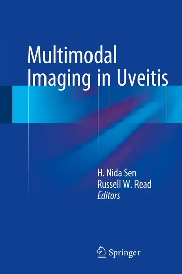 Cover of Multimodal Imaging in Uveitis