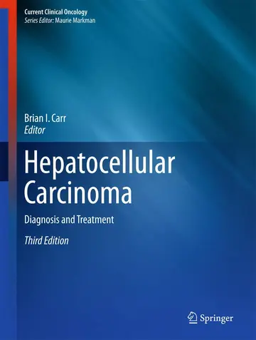 Cover of Hepatocellular Carcinoma