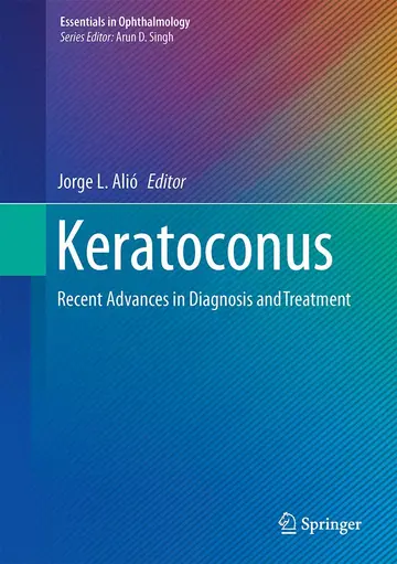 Cover of Keratoconus