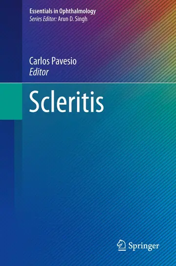 Cover of Scleritis