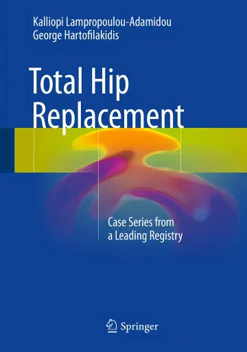 Cover of Total Hip Replacement