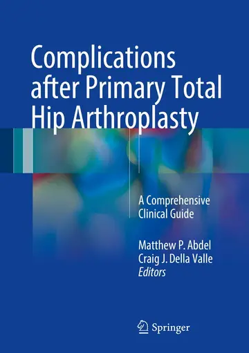 Cover of Complications after Primary Total Hip Arthroplasty