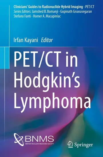 Cover of PET/CT in Hodgkin’s Lymphoma