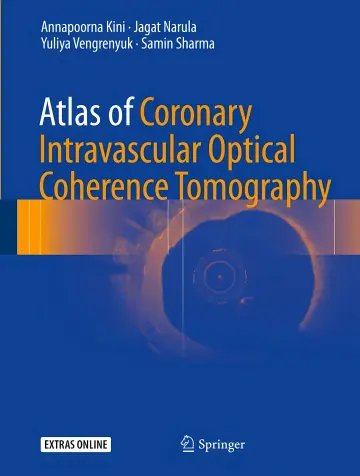 Cover of Atlas of Coronary Intravascular Optical Coherence Tomography