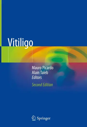 Cover of Vitiligo