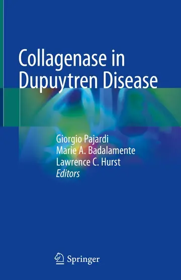 Cover of Collagenase in Dupuytren Disease