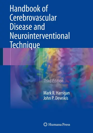 Cover of Handbook of Cerebrovascular Disease and Neurointerventional Technique