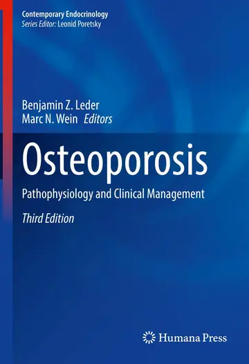 Cover of Osteoporosis