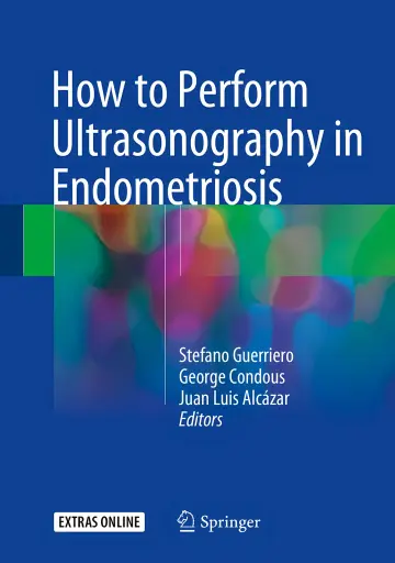 Cover of How to Perform Ultrasonography in Endometriosis 1st ed