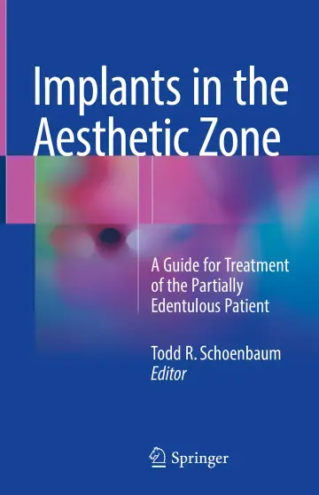 Cover of Implants in the Aesthetic Zone
