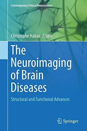 Cover of The Neuroimaging of Brain Diseases