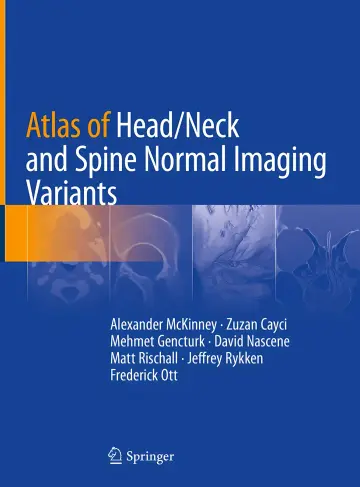 Cover of Atlas of Head/Neck and Spine Normal Imaging Variants