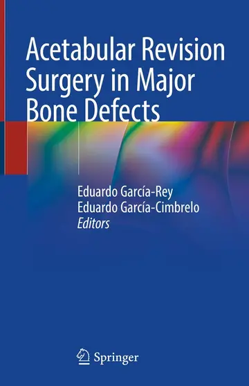 Cover of Acetabular Revision Surgery in Major Bone Defects