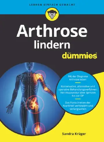 Cover of Arthrose lindern für Dummies