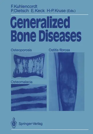 Cover of Generalized Bone Diseases