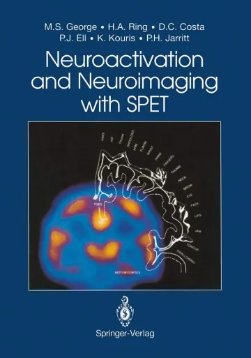 Cover of Neuroactivation and Neuroimaging with SPET