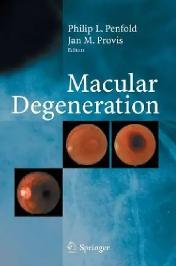 Cover of Macular Degeneration