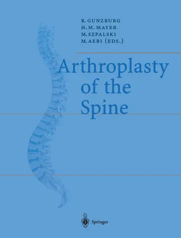 Cover of Arthroplasty of the Spine