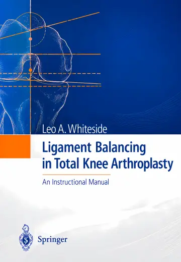 Cover of Ligament Balancing in Total Knee Arthroplasty