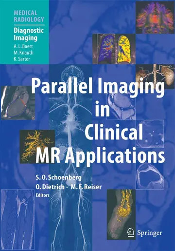 Cover of Parallel Imaging in Clinical Mr Applications
