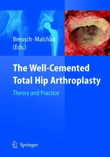 Cover of The Well-Cemented Total Hip Arthroplasty