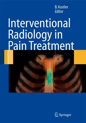 Cover of Interventional Radiology in Pain Treatment