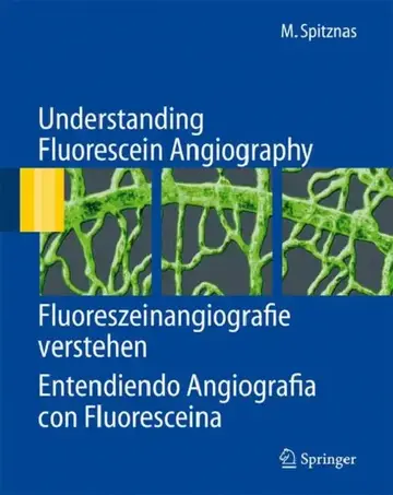 Cover of Understanding Fluorescein Angiography, Fluoreszeinangiografie verstehen, Entendiendo Angiografía con Fluoresceina