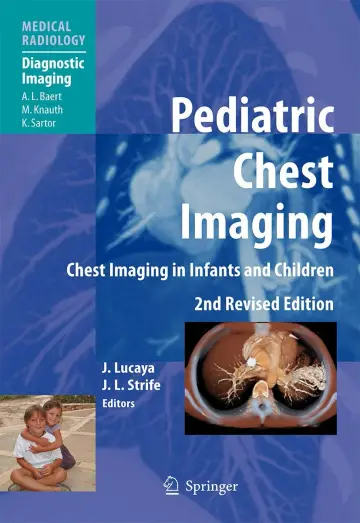Cover of Pediatric Chest Imaging