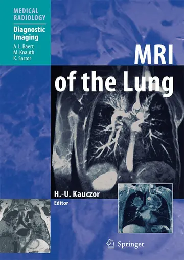 Cover of MRI of the Lung
