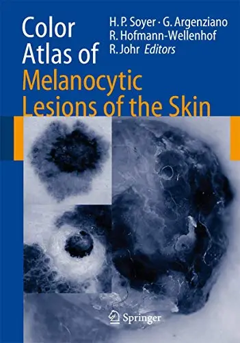 Cover of Color Atlas of Melanocytic Lesions of the Skin