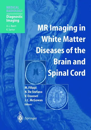Cover of Mr Imaging in White Matter Diseases of the Brain and Spinal Cord