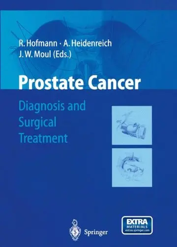 Cover of Prostate Cancer Diagnosis and Surgical Treatment