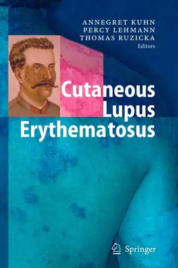 Cover of Cutaneous Lupus Erythematosus