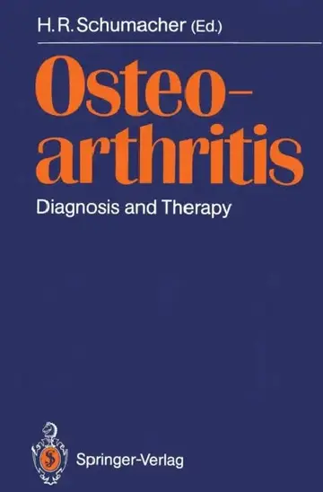 Cover of Osteoarthritis