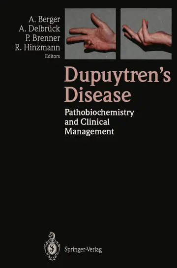 Cover of Dupuytren’s Disease