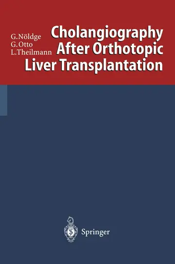 Cover of Cholangiography After Orthotopic Liver Transplantation