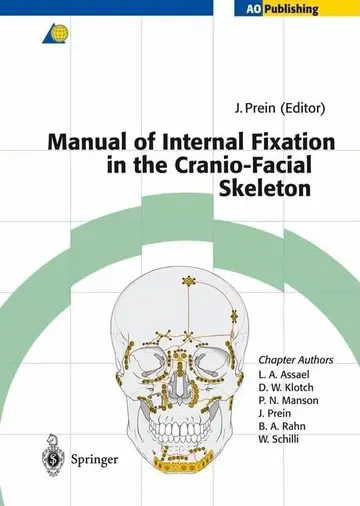 Cover of Manual of Internal Fixation in the Cranio-Facial Skeleton