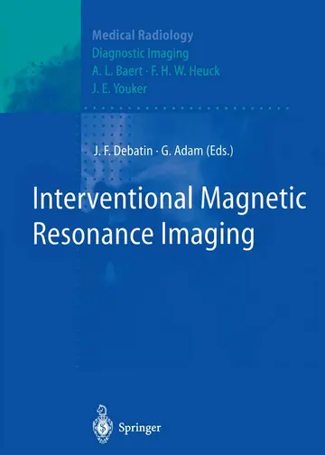 Cover of Interventional Magnetic Resonance Imaging