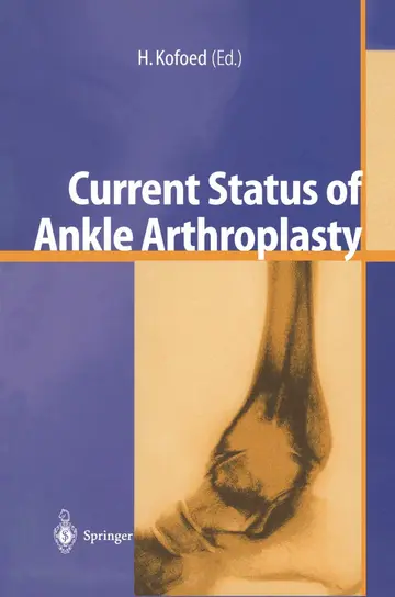 Cover of Current Status of Ankle Arthroplasty