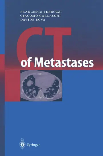 Cover of CT of Metastases