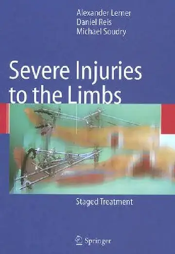 Cover of Severe Injuries to the Limbs