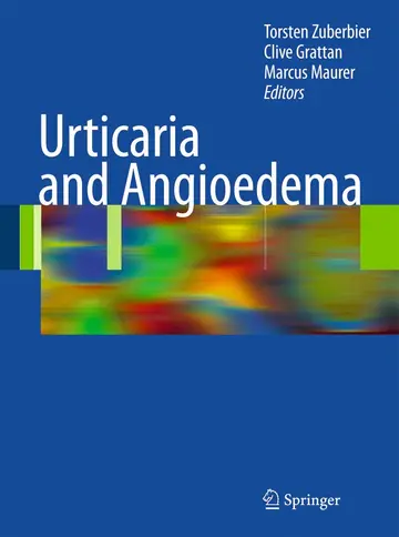 Cover of Urticaria and Angioedema