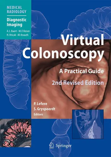 Cover of Virtual Colonoscopy