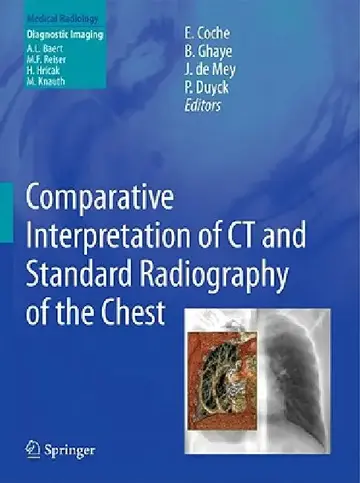 Cover of Comparative Interpretation of CT and Standard Radiography of the Chest