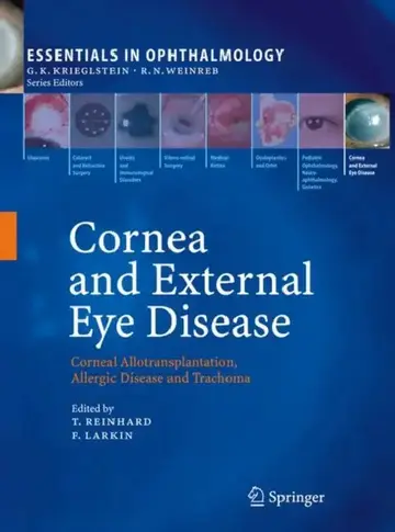 Cover of Cornea and External Eye Disease