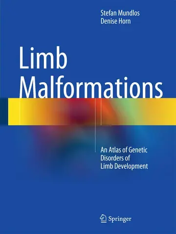 Cover of Limb Malformations