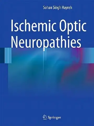 Cover of Ischemic Optic Neuropathies